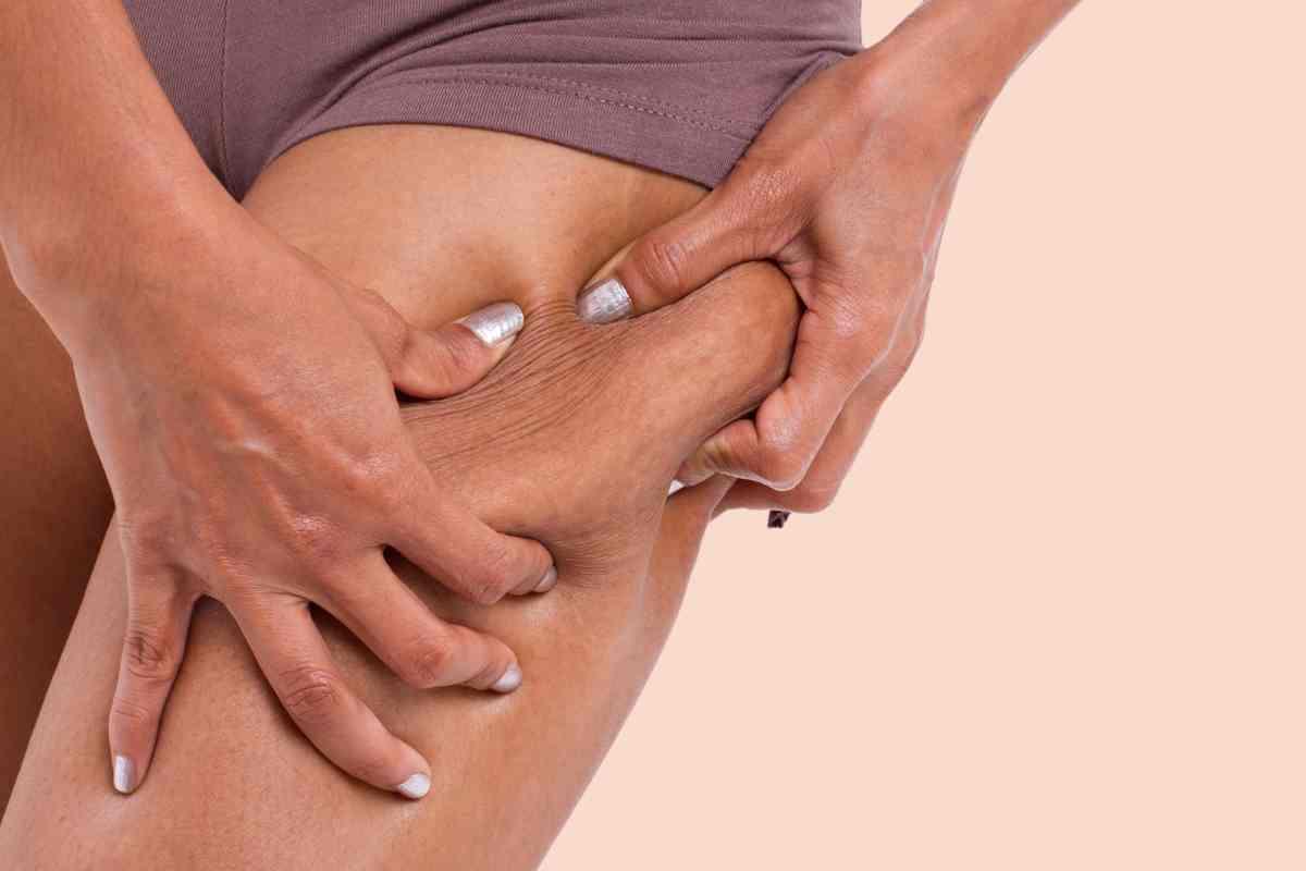 Come sconfiggere la cellulite